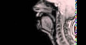 MRI voiceless alveolar affricate