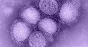 H1N1 Influenza (Gripe porcina) (Swine Flu)