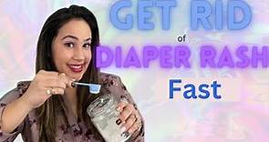 5 Home Remedies for Diaper Rash That Really Work// Natural Diaper Rash Remedies.