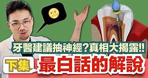 【史上最白話的抽神經解密(下)終於姍姍來遲了！】為什麼牙齒暴痛後會突然不痛了？不痛的牙齒之後會有什麼命運？挖蛀牙看到牙髓暴露就一定要抽神經嗎？什麼是活髓治療？和抽神經差在哪裡？