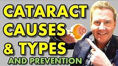 WHAT CAUSES CATARACT & HOW TO PREVENT CATARACTS: youtube eye doctor optometrist explains