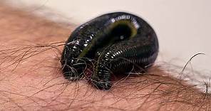 How Leeches are used in Modern Surgery | Earth Science