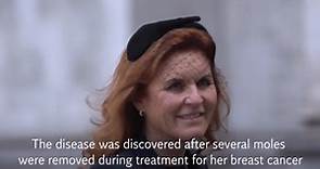 Sarah Ferguson diagnosed with skin cancer just months after breast cancer treatment