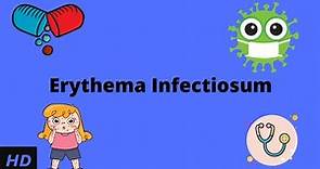 Erythema Infectiosum, Causes, Signs and Symptoms, Diagnosis and Treatment.