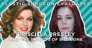 Priscilla Presley Plastic Surgery: Illegal Silicone + Fake Doctors = Botched