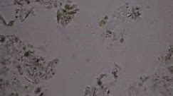 Entamoeba histolytica trophozoite video - Medical Laboratories