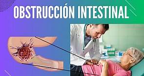 Obstrucción intestinal. Perlas