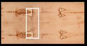 Blood on The Shroud of Turin?