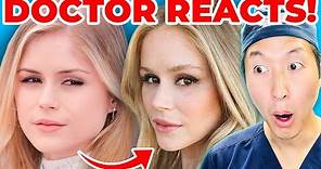 Erin Moriarty's (STARLIGHT From The BOYS) Plastic Surgery Transformation? - Dr. Anthony Youn