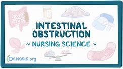 Intestinal obstruction: Nursing - Biblioteca de Osmosis