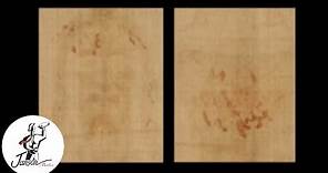 The Shroud of Turin Blood Stains