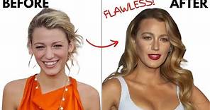 Why Blake Lively's Nose Job is Brilliant ( and 7 other celebrity plastic surgeries)