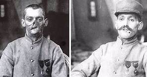 Sculptor Made Masks for Wounded WWI Soldiers with Disfigured Faces | New York Post