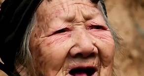 Zhang Ruifang, es una mujer que vive feliz, a pesar de tener cuernos de 6cm en la frente. #zhangruifang #mujer #mujerconcuernos #récordguiness #personasunicas #superación #historiareal #abuelacabra #viralreels #inspiracion | GoldenTube Tops