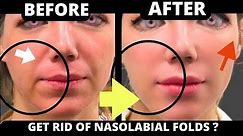 MIX | 17 MIN | HOW TO GET RID OF NASOLABIAL FOLDS ? LAUGH LINES | SAGGY SKIN, JOWLS | EYES