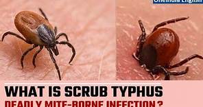 Scrub Typhus kills 5 in Odisha, 9 in Shimla | Know about this deadly infection | Oneindia News