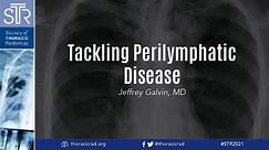 HRCT: Tackling Perilymphatic Disease