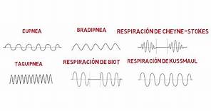 Patrones respiratorios (Eupnea, Bradipnea, Taquipnea, Biot, Cheyne-Stokes y Kussmaul)