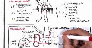 Septic Arthritis - Overview (causes, pathophysiology, treatment)