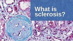 What is Sclerosis? - Pathology mini tutorial