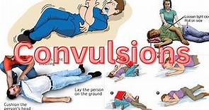 Convulsions/Symptoms, causes and management of convulsions/Difference between seizures & convulsions