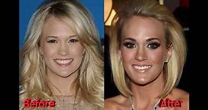 Did Carrie Underwood Really Get Plastic Surgery