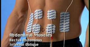 Compex Electrode Pad Placement Guide