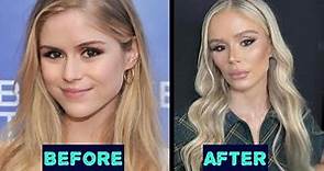 Actress Erin Moriarty Plastic Surgery Before And After
