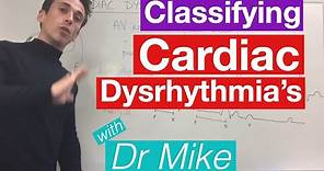 Cardiac dysrhythmias (arrhythmias) (common)
