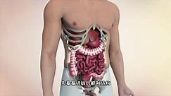 结肠癌怎么早发现？结肠癌的发生过程，3D演示。。