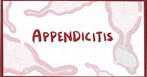 Appendicitis - causes, symptoms, diagnosis, treatment & pathology