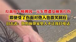 7月28日 #浙江丽水 拉黄包车师傅因一元遭女顾客打伤，即使受了伤面对他人也微笑回应，目击者：他怕麻烦家里人不让我打电话。 #破防