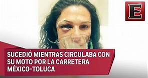 Ana Gabriela Guevara fue brutalmente golpeada
