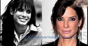 Courteney Cox Plastic Surgery Before and After HD
