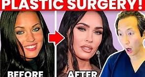 Plastic Surgeon Reacts to MEGAN FOX Cosmetic Surgery Transformation!