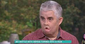 Tom Ray describes battle with sepsis ahead of Starfish premiere