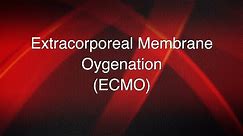 Extracorporeal membrane oxygenation (ECMO)