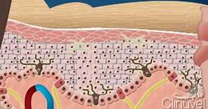 What is skin? The layers of human skin