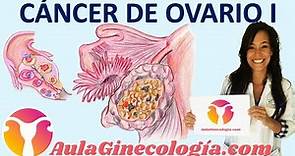 CÁNCER DE OVARIO: TIPOS, FACTORES de RIESGO, SÍNTOMAS, DIAGNÓSTICO... - Ginecología y Obstetricia -