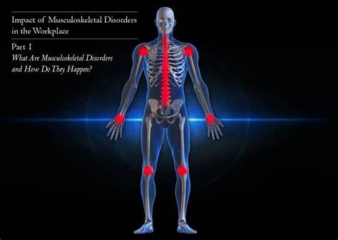 Muskuloskeletal Disorders