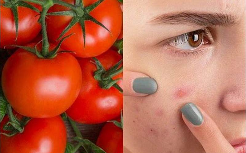  Cara Menggunakan Tomat Untuk Menghilangkan Jerawat 