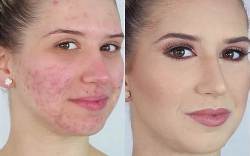  Cara Menutupi Jerawat Dengan Makeup 