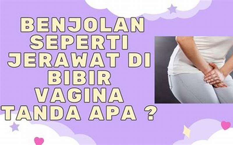  Jerawat Di Vagina, Apa Yang Harus Dilakukan? 