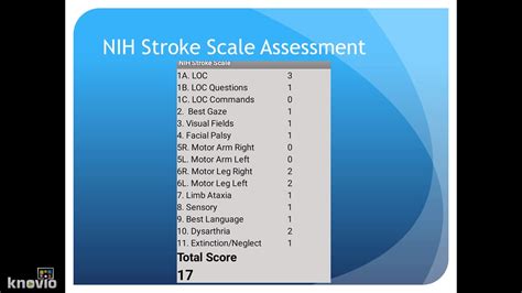 "Unlocking the Code: Navigating NIH Stroke Test Answers with Precision"