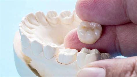 $Type and Material of the Temporary Crown$