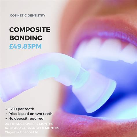 Typical cost range for composite bonding