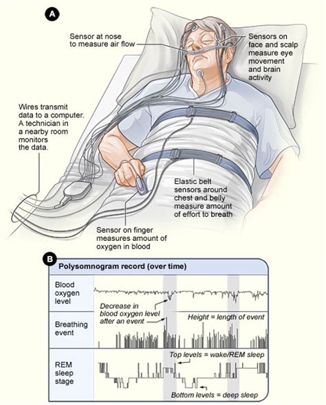 Components of a Polysomnography Wiring Diagram