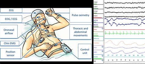 Components of a Polysomnography Wiring Diagram