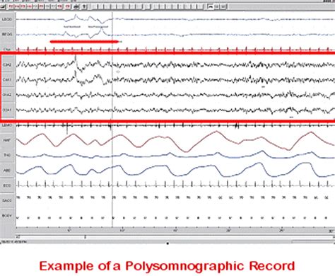 Introduction to Wiring Diagrams in Polysomnography