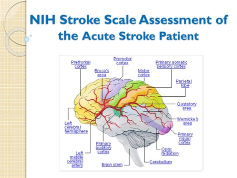 NIHSS in Predicting Stroke Outcomes